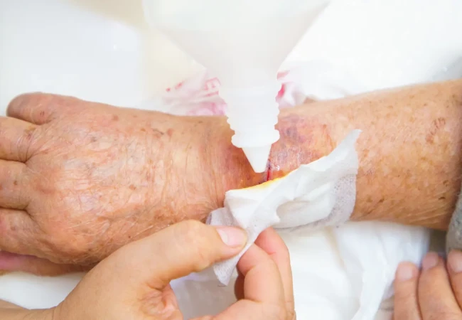 Click here to learn more about acute and chronic wounds