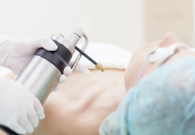 Click here to learn more about skin treatment after cryotherapie