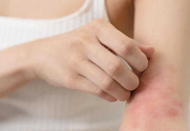 Click here to learn more about acute and chronic itch