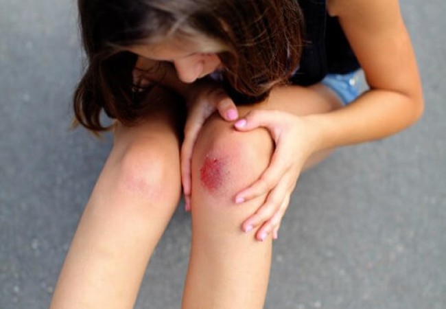 Click here to learn more about grazes